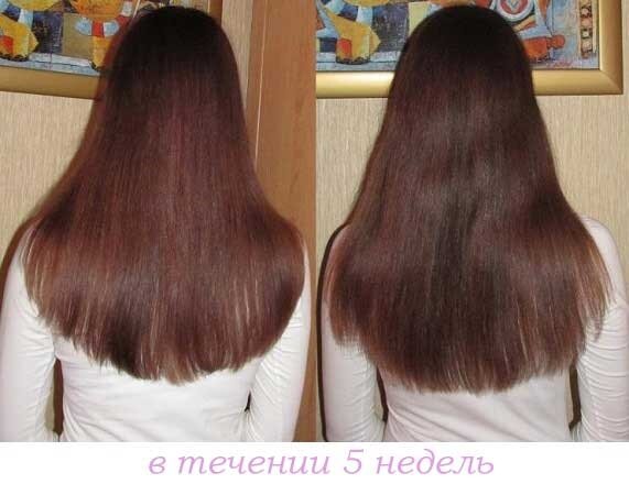 До и после никотиновой кислоты для волос, фото